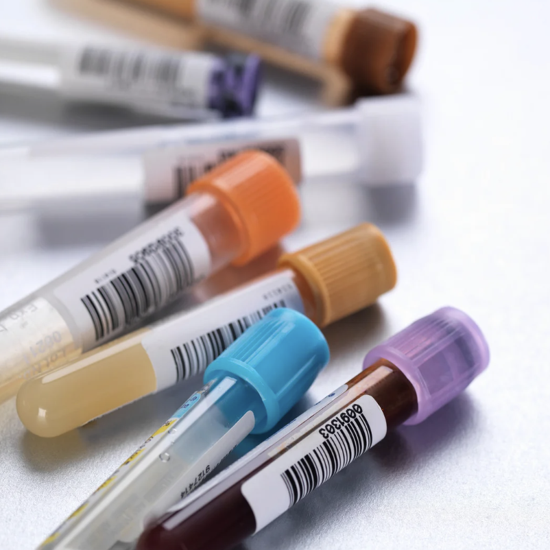 drug and Alcohol screening